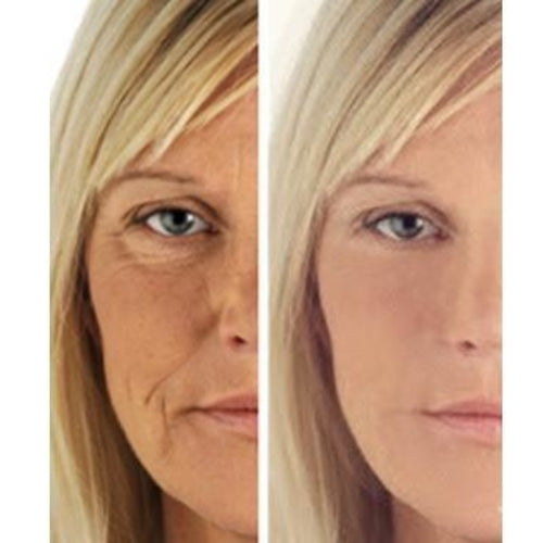 Age Perfect: Creme Reparador Noturno + Sérum Vitamina C+