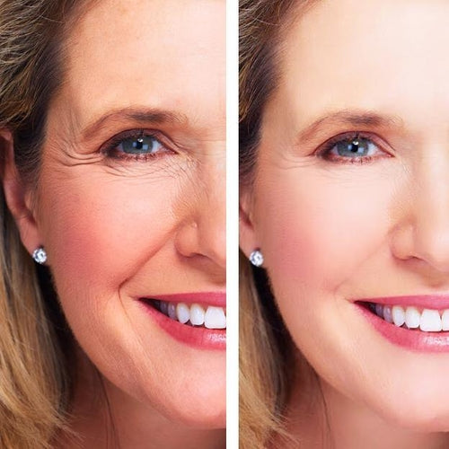 Age Perfect: Creme Reparador Noturno + Sérum Vitamina C+